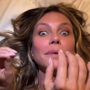 Heidi Klum hatte kurz vorm GNTM-Finale ein Pickelproblem