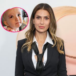 Autsch! Hilaria Baldwins Tochter (1) hat ein blaues Auge