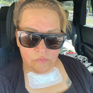 Post mit XXL-Pflaster: Ilka Bessin hatte eine Operation!