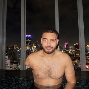 Influencer Justin Bunyai spricht offen über den Armverlust