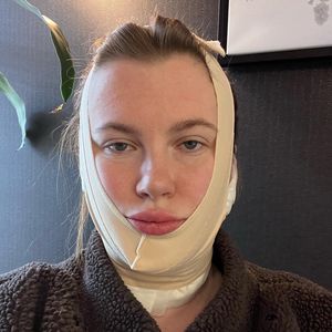 Darum unterzog sich Ireland Baldwin mit 26 einem Facelifting