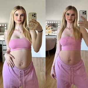 "Überwindung": So sieht Bauch von Jasi_xx3 nach Geburt aus
