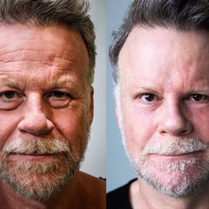 War Jenke-Experiment noch harmlos? Das sagt ein Beauty-Doc