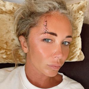 Kopfverletzung: Atomic-Kitten-Star Jenny Frost in Klinik