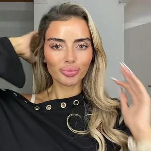 Fans lieben es: Jenny Grassl präsentiert Filler-Auflösung
