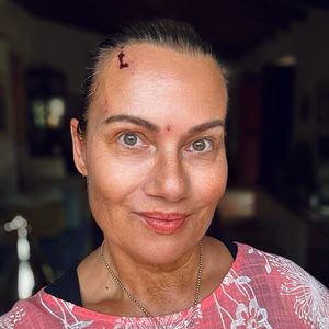 Wunden im Gesicht: Jenny Jürgens zeigt sich tapfer im Netz