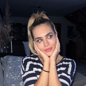 Jessica Haller hatte nach ihrer Beauty-OP eine Panikattacke
