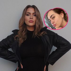 Hyperpigmentierung: Jessica Paszka zeigt sich ohne Filter!