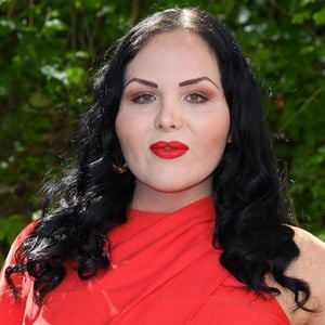 Realitystar Jessica Zemer bereut ihre Hyaluron-Lippen heute