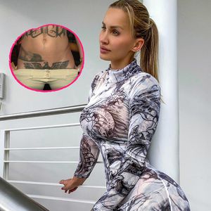 Instagram-Model ließ sich Reichsadler-Tattoo rausschneiden