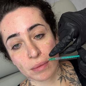 Nach Implantentfernung: Jolina Mennen lässt Lippen auflösen