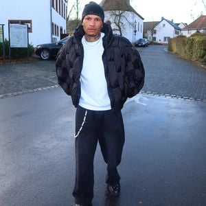 Darum wagte Jona Steinig seine zweite Haartransplantation