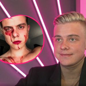 Bereut YouTuber Jonas Ems sein Menstruations-Blut-Foto?