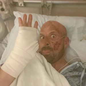 Nach seinem Horror-Unfall: Jonathan Goodwin ist gelähmt