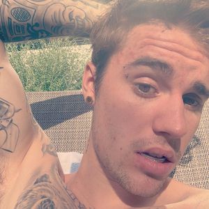 Drogenexzesse: Justin Bieber macht Ruhm dafür verantwortlich