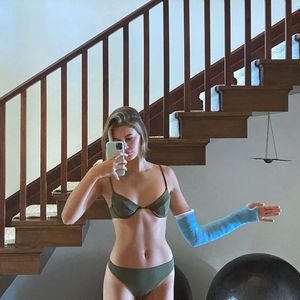 Im Bikini und mit XXL-Gips: Kaia Gerber hatte einen Unfall!