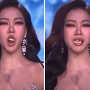 Misswahl-Panne: Kandidatin verliert falsche Zähne beim Posen