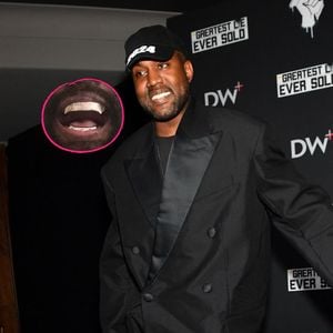 Skurril? Kanye West lässt Zähne entfernen für Titanprothese!
