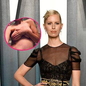 Komplett nackt: Karolina Kurkova ist jetzt in der 27. Woche