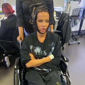 Kate Beckinsale teilt gnadenlos ehrliches Foto nach Zahn-OP
