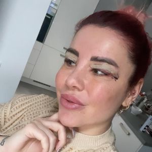 OP-Marathon? Kate Merlan war schon wieder beim Beauty-Doc