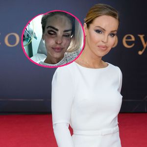400 OPs: Säure-Opfer Katie Piper meldet sich aus Krankenhaus