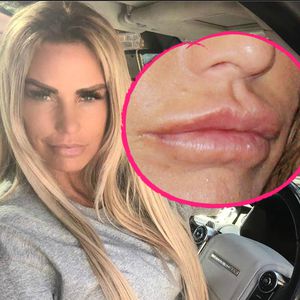 Dicke Botox-Lippen: War Katie Price erneut beim Beauty-Doc?