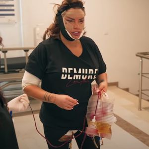 Nach OP-Marathon: Katie Price trägt Beutel mit eigenem Blut