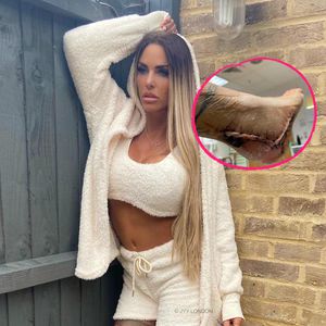 Zum Beweis: Katie Price teilt Fotos ihres genähten Fußes!