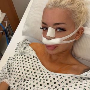 OP: Katja Krasavice hat jetzt ein Stück Rippe in ihrer Nase