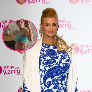 "Ich hasse mich": Kerry Katonas Körper ist stark geschwollen
