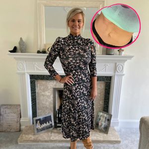 Atomic-Kitten-Star Kerry steht zu ihren Dehnungsstreifen