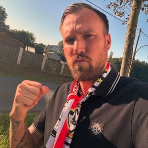 Kevin Großkreutz überrascht mit seiner Haartransplantation
