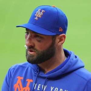 Blutige Bilder: Baseball-Star von Ball ins Gesicht getroffen