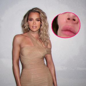 Khloé Kardashian zeigt krasse Beule nach ihrer Hautkrebs-OP