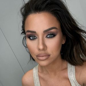 Botox: Kim Gloss macht kein Geheimnis um Beauty-Eingriffe