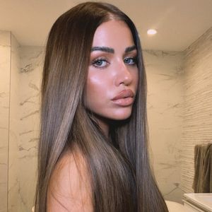 Kaum wiederzuerkennen: Kim Gloss verblüfft ihre Fans