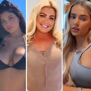 Beauty-Doc und Lipfiller ade! Stars rocken den Natural-Look