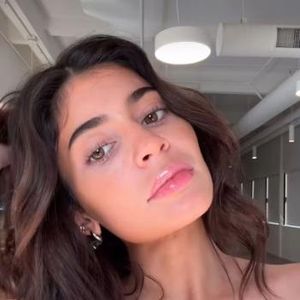 Filler-Entfernug: Fans loben Kylie Jenner für Natürlichkeit!