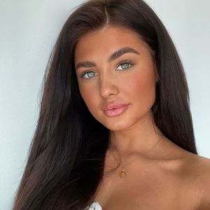Großer Eingriff: Hat "Love Island"-Laura Schiss vor Po-OP?