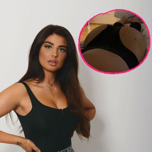"Love Island"-Laura: So geht's ihr nach Po-Vergrößerung!