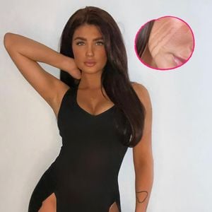 Selbstbräuner verschmiert: Laura Mania postet Tränen-Pic