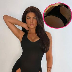 "Love Island"-Lauras Po-OP: 800 Milliliter Fett umverteilt