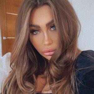 Hat Lauren Goodgers Freund ihr die Augenhöhle gebrochen?