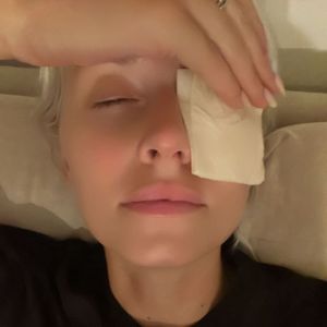Oje! Lena Gercke verletzt sich Auge bei "Haushaltsunfall"