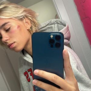 Sie zeigte Zivilcourage: Lena Mantler wurde selbst verletzt