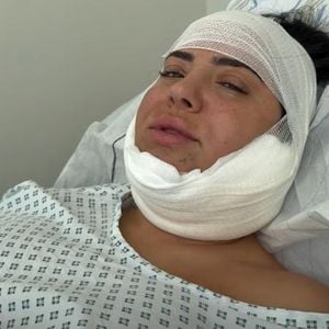 Fett gespritzt: Leyla Heiter ließ sich Doppelkinn absaugen