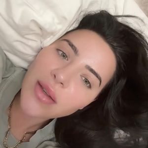 Leyla Lahouar zeigt ihre Lippen nach der Filler-Auflösung