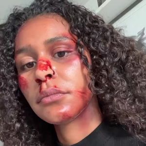 GNTM-Lijana erntet Kritik für ihr Foto mit blutigem Gesicht