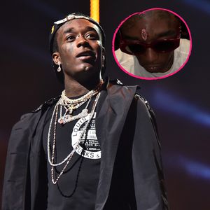 Rapper Lil Uzi Vert ließ sich rosa Diamant in Kopf piercen!